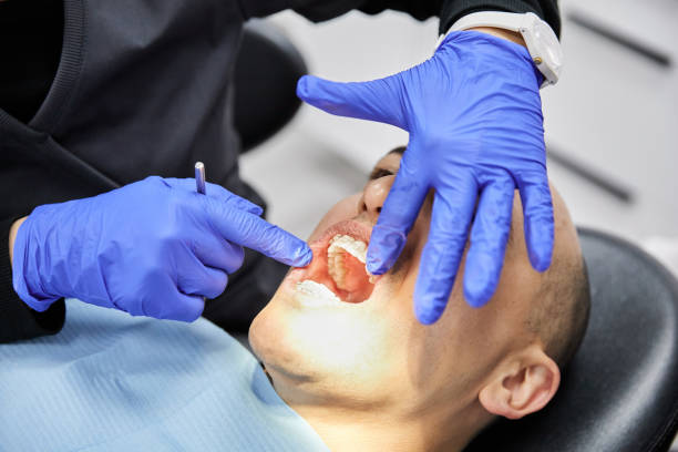 Best Emergency Dental Care for Abscessed Tooth in East Quincy, CA