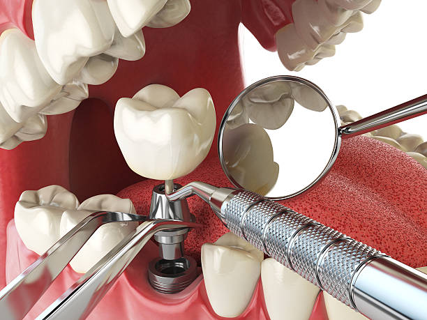 Best Urgent Dental Care for Toothache in East Quincy, CA